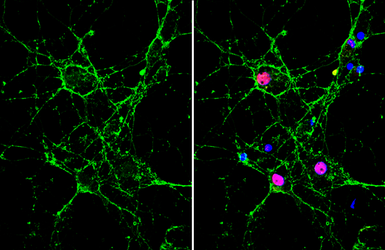 Anti-NCAM antibody [GT249] used in Immunocytochemistry/ Immunofluorescence (ICC/IF). GTX634807
