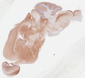 Anti-NCAM antibody [GT249] used in IHC (Paraffin sections) (IHC-P). GTX634807