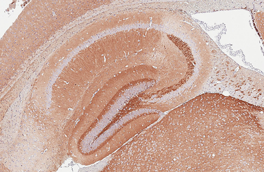 Anti-NCAM antibody [GT249] used in IHC (Paraffin sections) (IHC-P). GTX634807