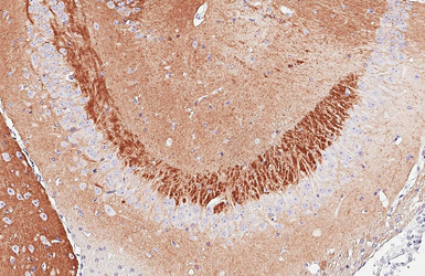 Anti-NCAM antibody [GT249] used in IHC (Paraffin sections) (IHC-P). GTX634807