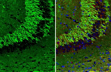 Anti-NCAM antibody [GT249] used in IHC (Paraffin sections) (IHC-P). GTX634807