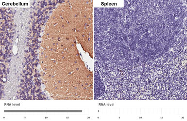Anti-NCAM antibody [GT249] used in IHC (Paraffin sections) (IHC-P). GTX634807