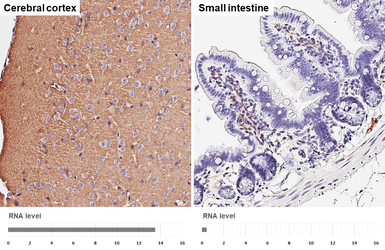 Anti-NCAM antibody [GT249] used in IHC (Paraffin sections) (IHC-P). GTX634807