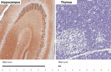 Anti-NCAM antibody [GT249] used in IHC (Paraffin sections) (IHC-P). GTX634807