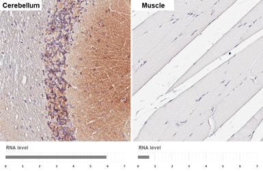 Anti-NCAM antibody [GT249] used in IHC (Paraffin sections) (IHC-P). GTX634807