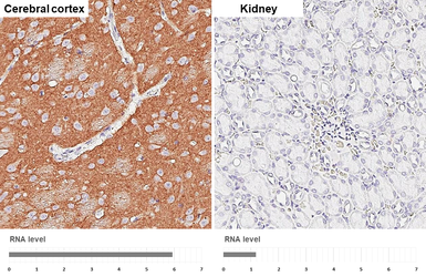 Anti-NCAM antibody [GT249] used in IHC (Paraffin sections) (IHC-P). GTX634807