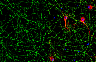 Anti-Tau antibody [GT287] used in Immunocytochemistry/ Immunofluorescence (ICC/IF). GTX634809