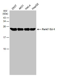Anti-Park7 / DJ-1 antibody [GT1412] used in Western Blot (WB). GTX634811