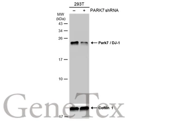 Anti-Park7 / DJ-1 antibody [GT1412] used in Western Blot (WB). GTX634811