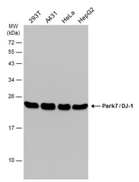 Anti-Park7 / DJ-1 antibody [GT136] used in Western Blot (WB). GTX634831