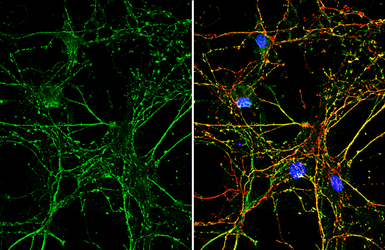 Anti-Park7 / DJ-1 antibody [GT136] used in Immunocytochemistry/ Immunofluorescence (ICC/IF). GTX634831