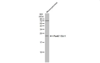 Anti-Park7 / DJ-1 antibody [GT136] used in Western Blot (WB). GTX634831
