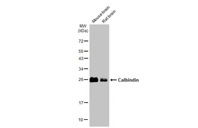 Anti-Calbindin antibody [GT386] used in Western Blot (WB). GTX634833
