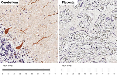 Anti-Calbindin antibody [GT386] used in IHC (Paraffin sections) (IHC-P). GTX634833
