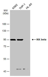 Anti-IKK beta antibody [GT685] used in Western Blot (WB). GTX634834