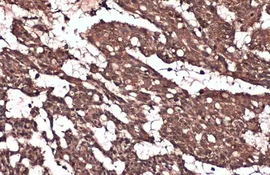 Anti-IKK beta antibody [GT685] used in IHC (Paraffin sections) (IHC-P). GTX634834