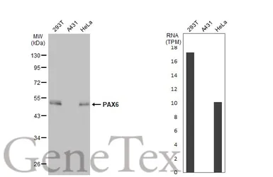Anti-PAX6 antibody [GT9412] used in Western Blot (WB). GTX634863