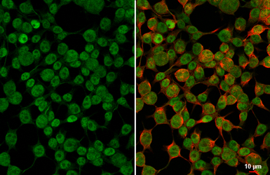 Anti-PAX6 antibody [GT9412] used in Immunocytochemistry/ Immunofluorescence (ICC/IF). GTX634863