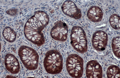 Anti-Galectin 3 antibody [GT1473] used in IHC (Paraffin sections) (IHC-P). GTX635151