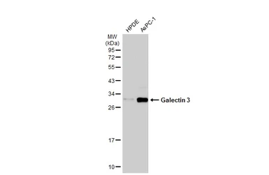 Anti-Galectin 3 antibody [GT759] used in Western Blot (WB). GTX635152