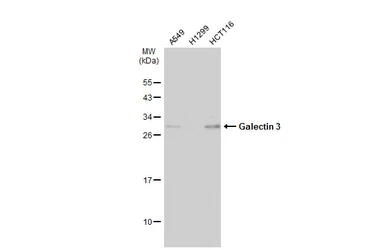 Anti-Galectin 3 antibody [GT12712] used in Western Blot (WB). GTX635155
