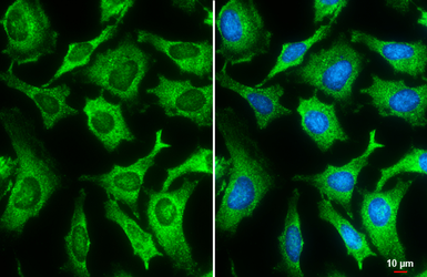 Anti-Galectin 3 antibody [GT12712] used in Immunocytochemistry/ Immunofluorescence (ICC/IF). GTX635155