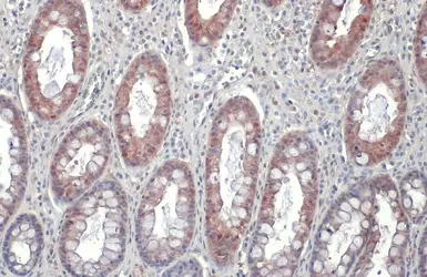 Anti-Galectin 3 antibody [GT12712] used in IHC (Paraffin sections) (IHC-P). GTX635155