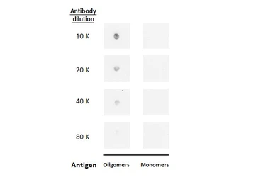Anti-beta Amyloid (1-42) antibody – Conformation Specific antibody [GT622] used in Dot blot (Dot). GTX635160