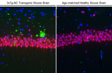 Anti-beta Amyloid (1-42) antibody – Conformation Specific antibody [GT622] used in IHC (Paraffin sections) (IHC-P). GTX635160