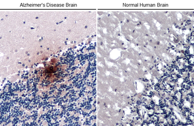 Anti-beta Amyloid (1-42) antibody – Conformation Specific antibody [GT622] used in IHC (Paraffin sections) (IHC-P). GTX635160