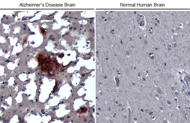 Anti-beta Amyloid (1-42) antibody – Conformation Specific antibody [GT622] used in IHC (Paraffin sections) (IHC-P). GTX635160