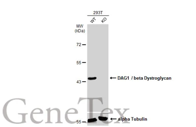 Anti-DAG1 / beta Dystroglycan antibody [GT835] used in Western Blot (WB). GTX635179