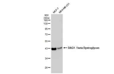 Anti-DAG1 / beta Dystroglycan antibody [GT2812] used in Western Blot (WB). GTX635180