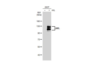 Anti-AXL antibody [GT1174] used in Western Blot (WB). GTX635210