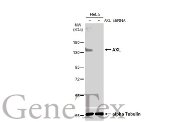 Anti-AXL antibody [GT1174] used in Western Blot (WB). GTX635210