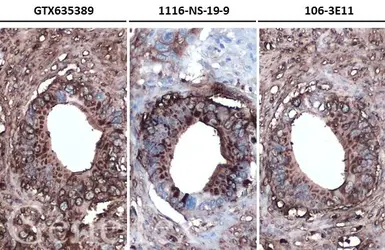 Anti-CA19-9 antibody [GT933] used in IHC (Paraffin sections) (IHC-P). GTX635389
