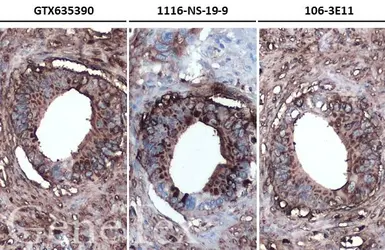 Anti-CA19-9 antibody [GT252] used in IHC (Paraffin sections) (IHC-P). GTX635390