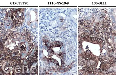 Anti-CA19-9 antibody [GT252] used in IHC (Paraffin sections) (IHC-P). GTX635390