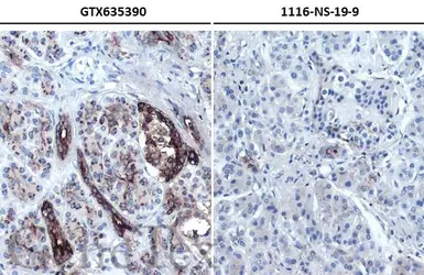 Anti-CA19-9 antibody [GT252] used in IHC (Paraffin sections) (IHC-P). GTX635390
