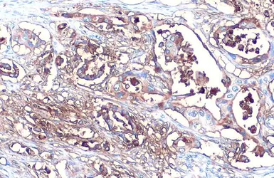 Anti-CA19-9 antibody [GT252] used in IHC (Paraffin sections) (IHC-P). GTX635390