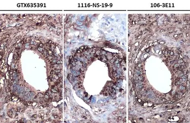 Anti-CA19-9 antibody [GT8510] used in IHC (Paraffin sections) (IHC-P). GTX635391