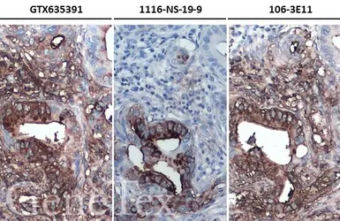 Anti-CA19-9 antibody [GT8510] used in IHC (Paraffin sections) (IHC-P). GTX635391