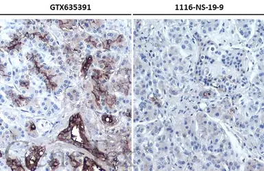 Anti-CA19-9 antibody [GT8510] used in IHC (Paraffin sections) (IHC-P). GTX635391