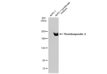 Anti-Thrombospondin 2 antibody [GT147] used in Western Blot (WB). GTX635393