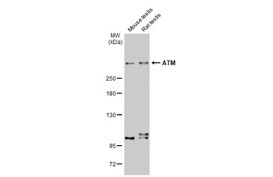 Anti-ATM antibody [2C1-RB] used in Western Blot (WB). GTX635395