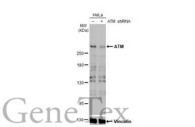 Anti-ATM antibody [2C1-RB] used in Western Blot (WB). GTX635395