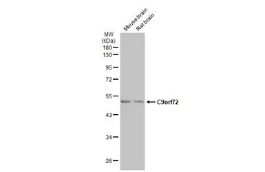 Anti-C9orf72 antibody [GT779-RB] used in Western Blot (WB). GTX635397