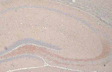 Anti-C9orf72 antibody [GT779-RB] used in IHC (Paraffin sections) (IHC-P). GTX635397
