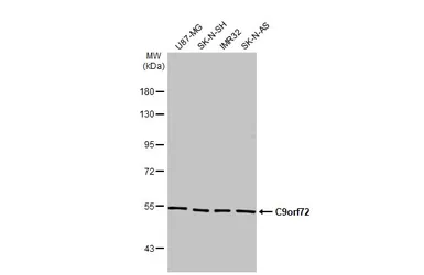 Anti-C9orf72 antibody [GT779-RB] used in Western Blot (WB). GTX635397