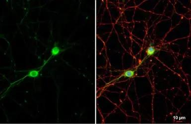 Anti-C9orf72 antibody [GT1553-RB] used in Immunocytochemistry/ Immunofluorescence (ICC/IF). GTX635398